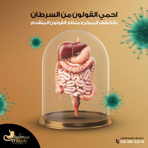 هل لحمية القولون سرطان؟